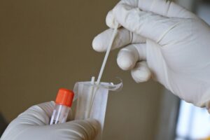 Scopri di più sull'articolo Test sierologico: le differenze tra qualitativo e quantitativo