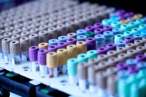 Scopri di più sull'articolo Test sierologico quantitativo per il Covid-19: è il caso di continuare a farlo?